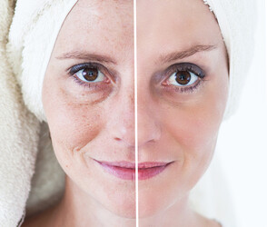 Vegan Collagen Boosting Serum